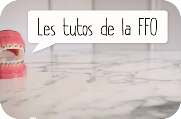 amovibles orthodontie castelnau le lez Nos conseils Cabinet d'orthodontie du Dr SIMEONI