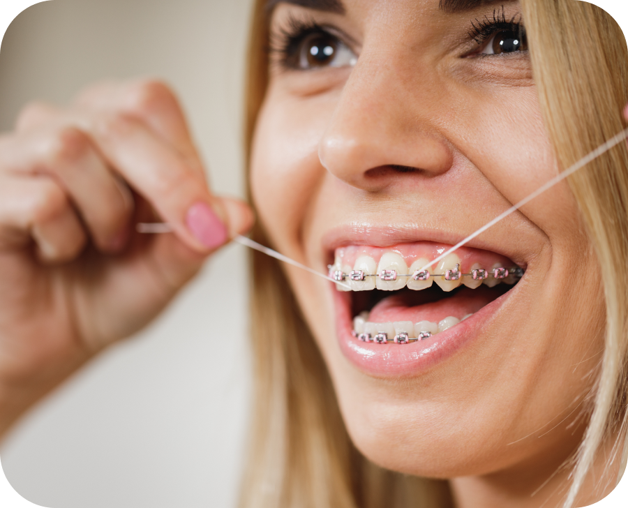 hygiene dentaire castelnau le lez Orthodontiste Clapiers Cabinet d'orthodontie du Dr SIMEONI